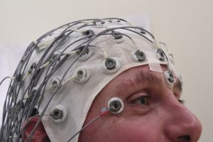 Brain electrodes